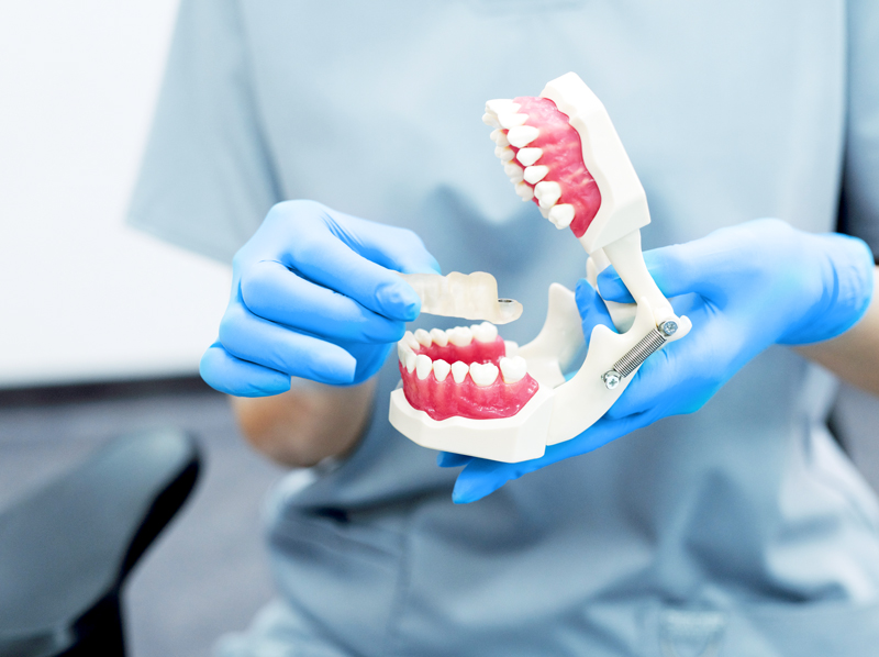 Vorschaubild Veneers